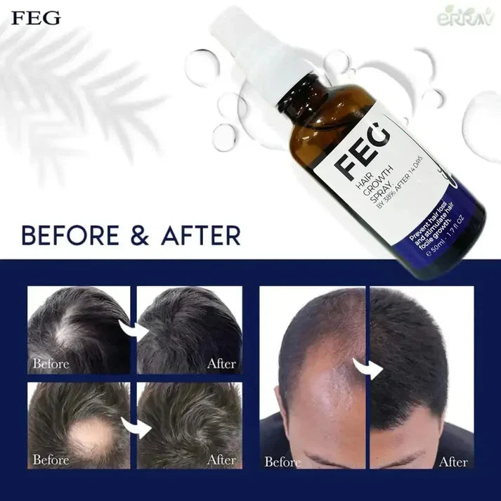 FEG PLUS Hair Growth Spray SERUM